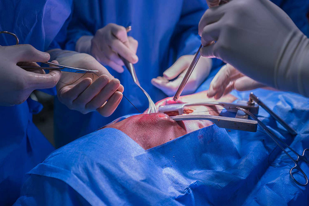 operation