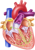 aortic valve diagram