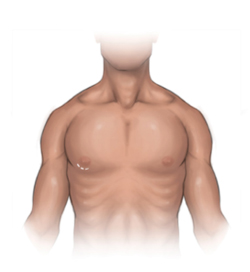 Keyhole approach to mitral valve