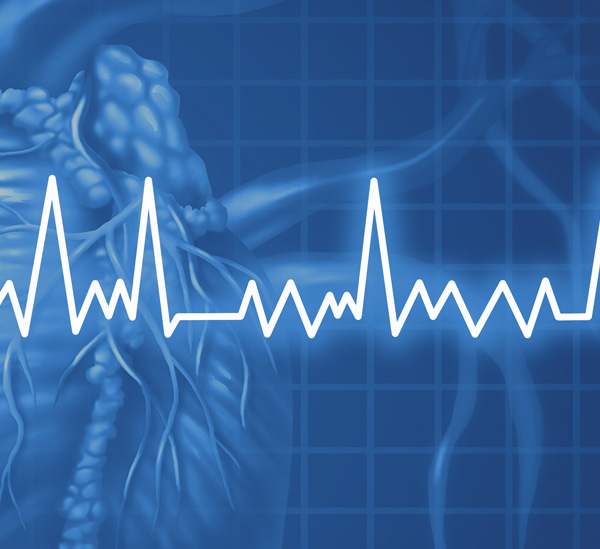 Ablation of Atrial Fibrillation