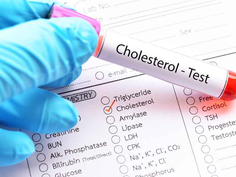 cholesterol tests