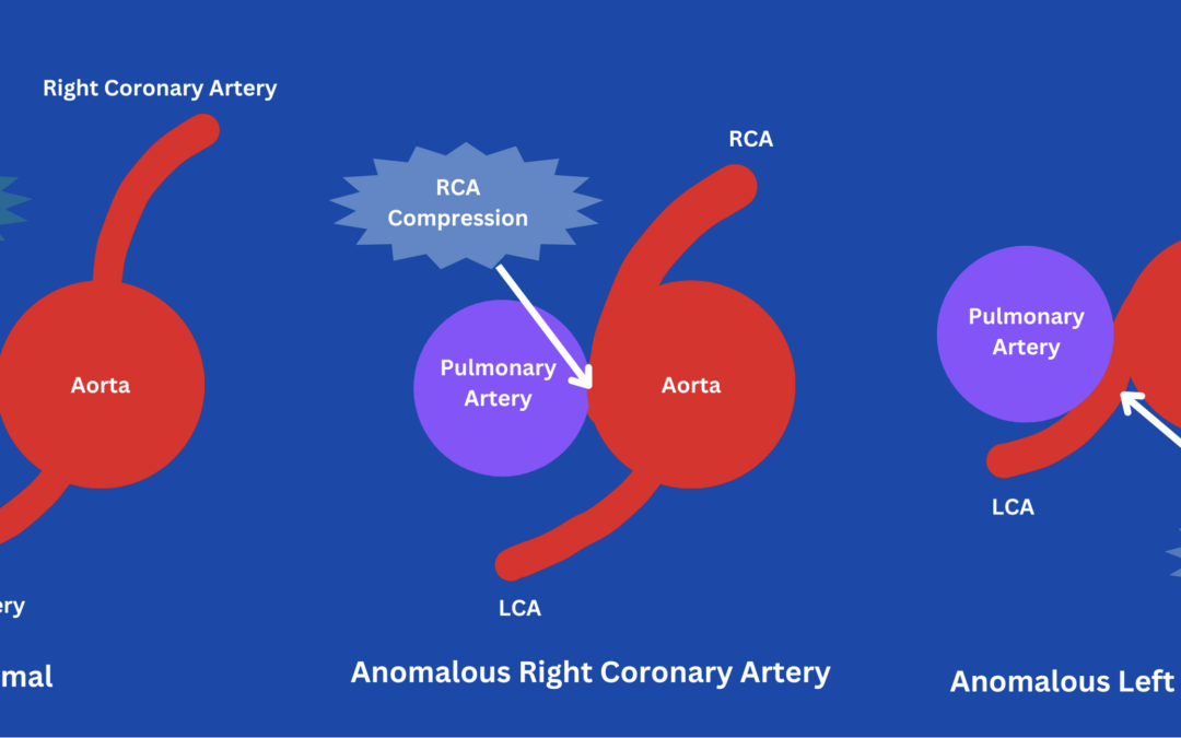 The Danger of Anomalous Coronary Artery Anatomy
